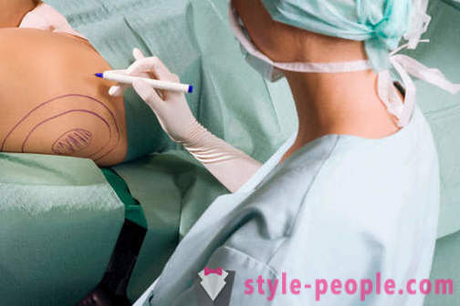 Пластични хирурзи уништити стереотипе о свом раду