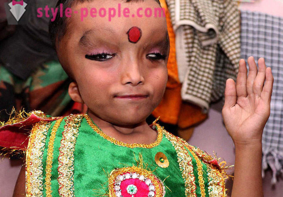 Индијски Село је обожаван дечака са деформисаним главом као бога Ганеша